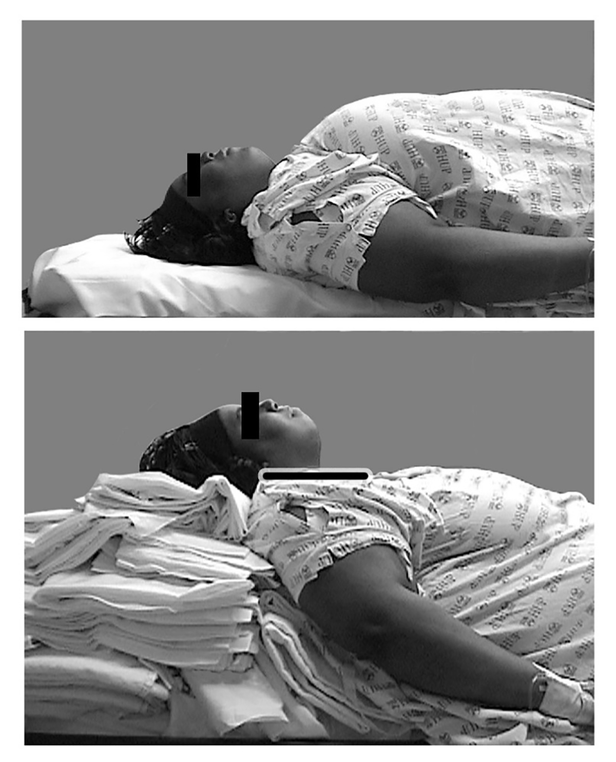 How do I position the patient